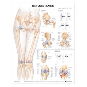 Wandplaat Hip & Knee